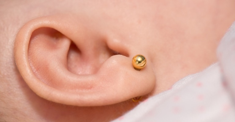 Correção da orelha de abano pode ser feita na infância