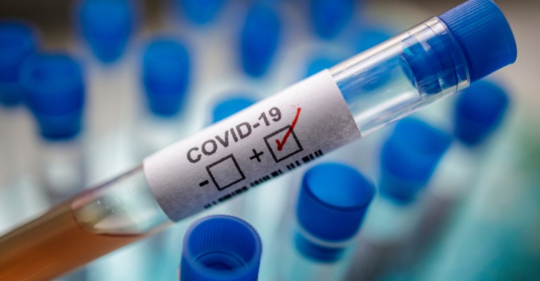 Baixo investimento em pesquisa faz Brasil importar testes para Covid-19