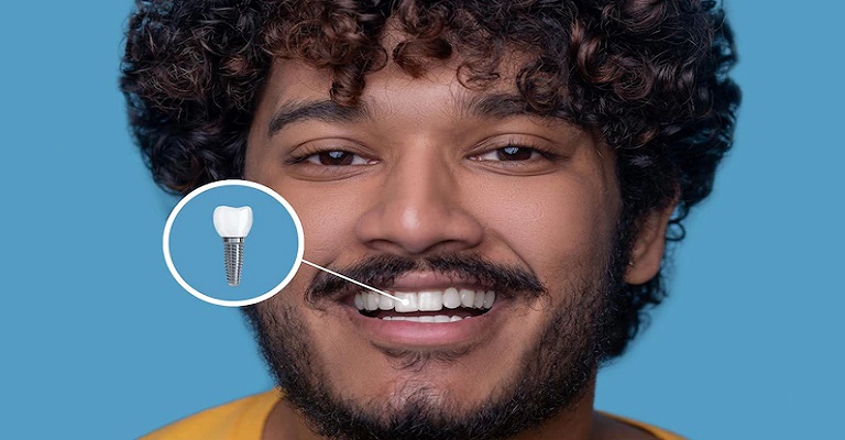 Saiba como o implante dentário pode aumentar a sua autoestima
